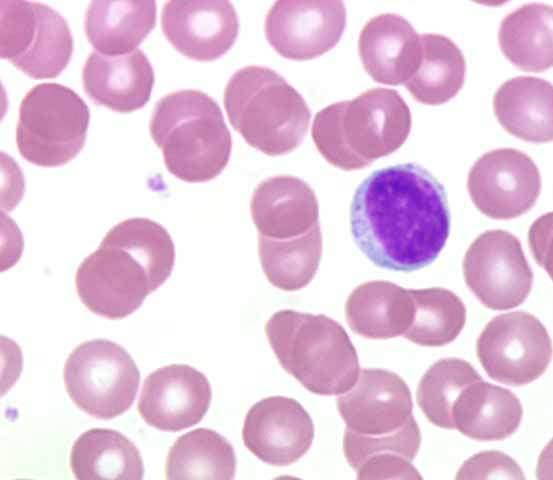 Lymphocytes (B Cells, T Cells, Natural Killer Cells) (Antibody mediated immunity) (Cell mediated immunity) Round shape (can change shape) Round densely stained acentric nuclei Sparse cytoplasm unless