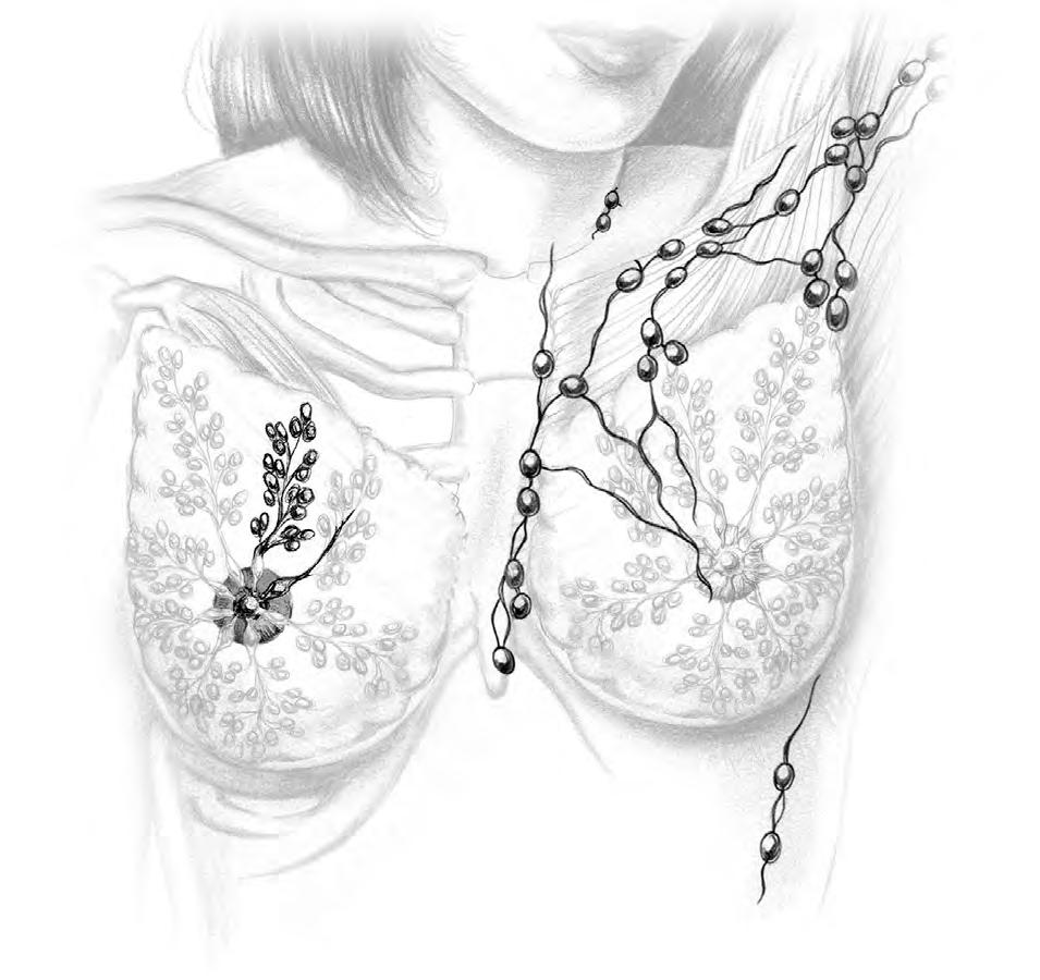 Breast Anatomy LOBULE LOBE ACINI (MILK PRODUCING UNITS) NIPPLE AREOLA COMPLEX ENLARGEMENT OF DUCT AND LOBE LOBULE
