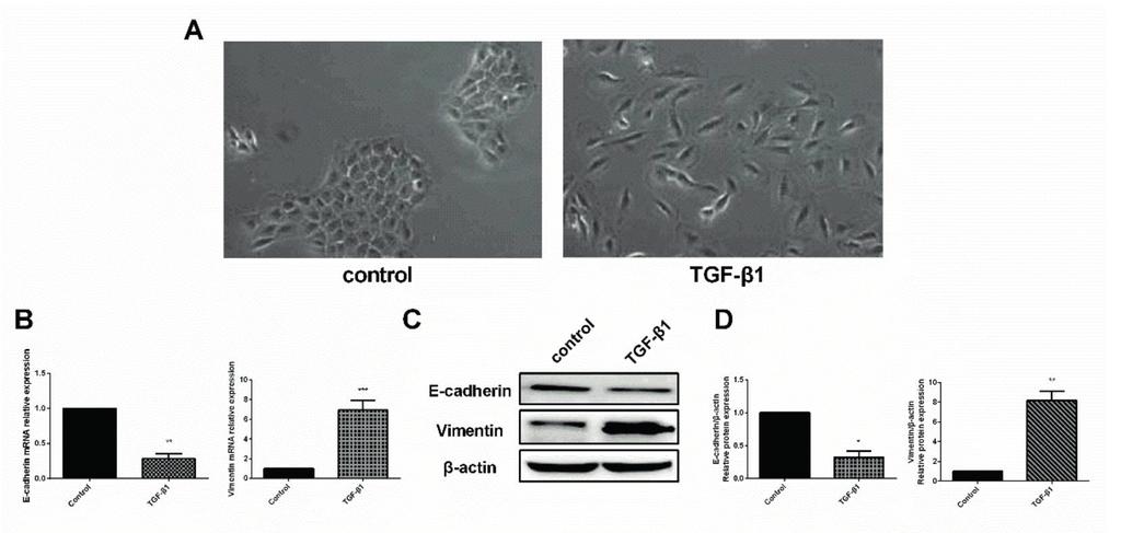 GLI-1 facilitates the EMT induced by TGF-β1 in gastric cancer and resuspending in the serum-free RPMI-1640 medium for single-cell suspension at a density of 2 10 5 /ml.