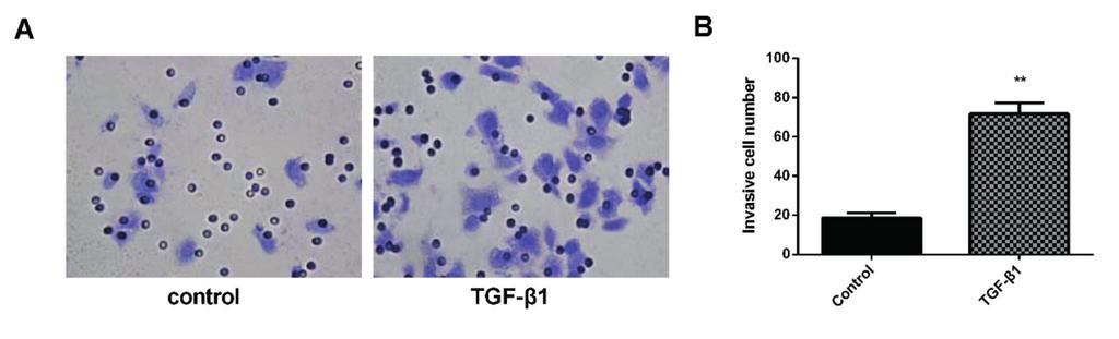M. Liang, X.-C. Liu, T. Liu, W.-J. Li, J.-G. Xiang, D. Xiao, Y.-L. Zhang, M.-H. Zheng, C. Zhai, et al. Figure 2. TGF-β1 promotes invasion of SGC-7901 cells (Coomassie brilliant blue staining 200).