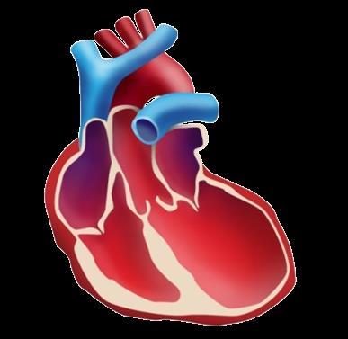 Dilated Cardiomyopathy (DCM): Devastating Disease with No Approved Therapies The DCM Heart Characterized by thin walls of left ventricle and hypocontractility Inadequate contraction and insufficient