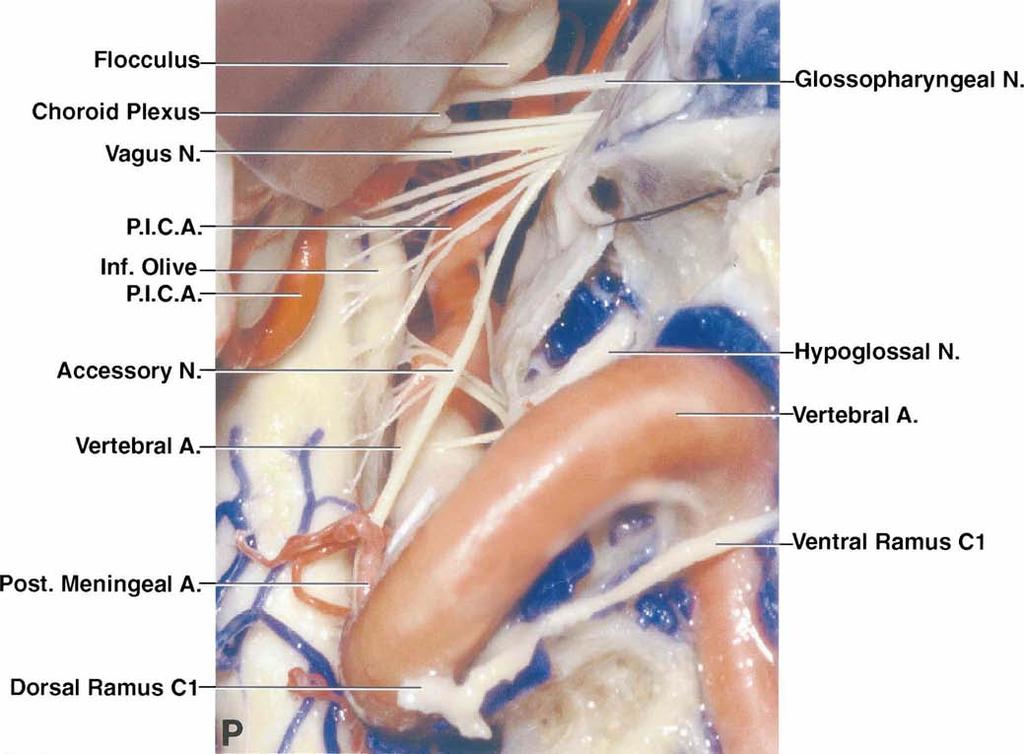H. T. Wen, et al. FIG. 2. P: The dura has been opened to expose the intradural course of the nerves entering the jugular foramen and the hypoglossal canal.