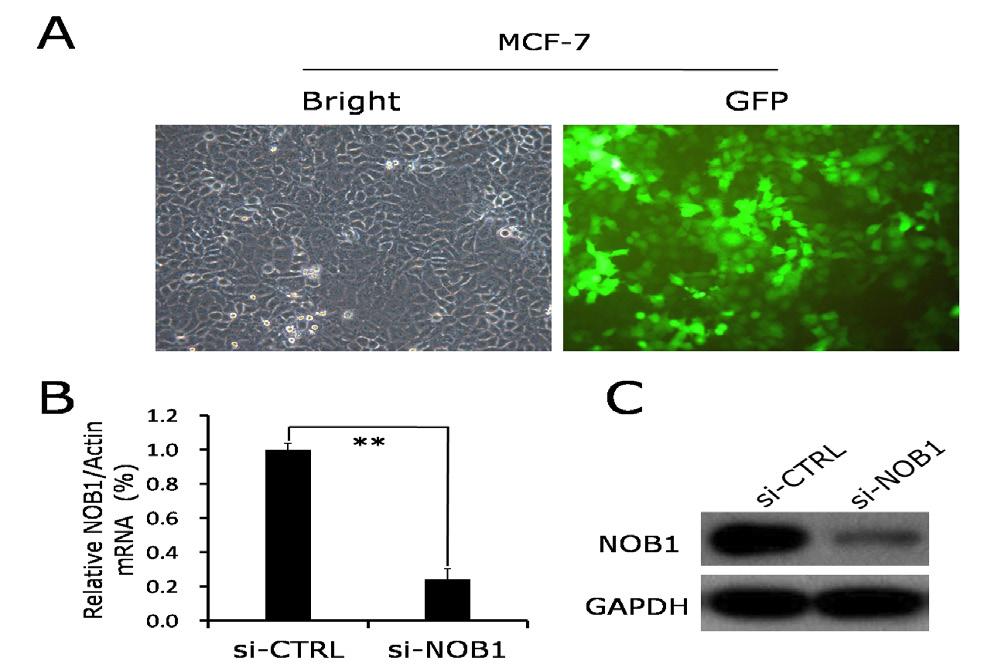Figure 1. Silencing of NOB1 Suppressed the NOB1 mrna and Protein Expression Levels in MCF-7 Cells. A.