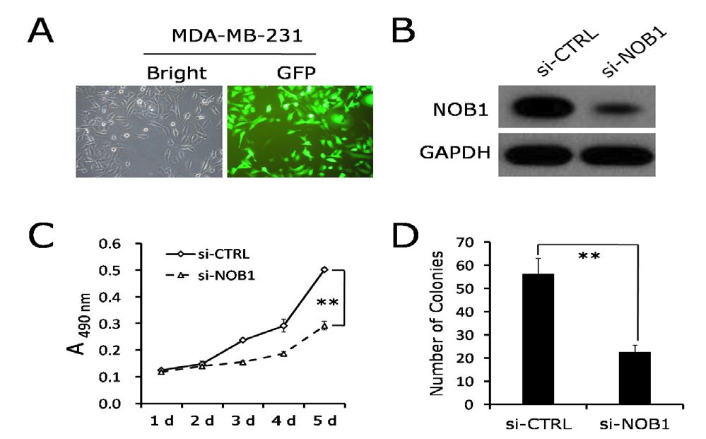 Wei-Yi Huang et al expression was markedly increased in the NOB1 absent cell group.