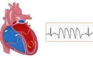 in vivo, little if any cardiac stimulation is noted.
