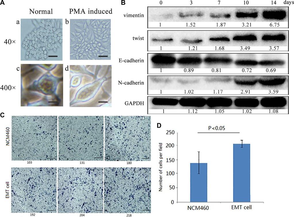 epithelia NCM460 and cancer HT29 cells to acquire EMT features, in which some proteins secreted by EMT cells are involved in this biological process.