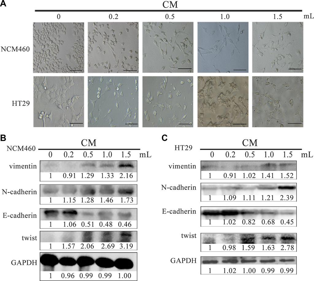 In order to further investigate STC2 secretion changes in cell-cell interactions between normal epithelia and colon cancer cells, the intracellular expression and extracellular secretion of STC2