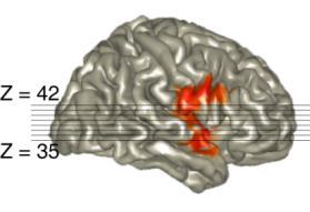 Early EEG correlates of deviance detection 8 EEG: Nb enhancement for frequency deviants a Grimm et al. (2011). Psychophysiology.