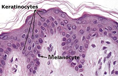 What are the different types of l Keratinocytes cells in the epidermis?