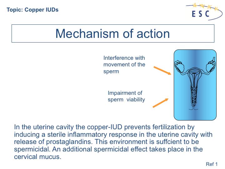 1. Ortiz, M. E et al. Mechanisms of action of intrauterine devices. Obstet & Gynl Survey 1996; 51(12), 42S-51S. The contraceptive action of all IUDs is mainly in the uterine cavity.