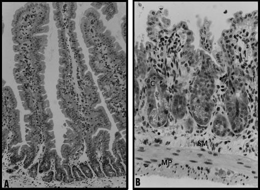 1998 Opioids and Chronic Inflammation 1071 Fig. 4. Optical microscopical examination of intestinal preparations obtained from the proximal jejunum. Transverse sections of jejunum 96 h after chronic p.