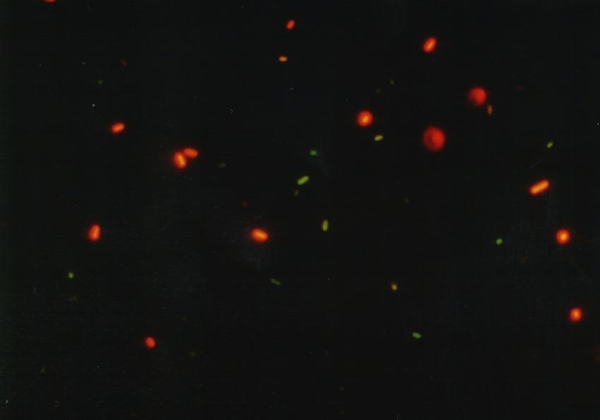 bacteria green) and Propidiumiodide (dead bacteria red) E.