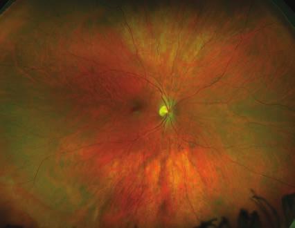 optomap color images provide a structural image of the retina.