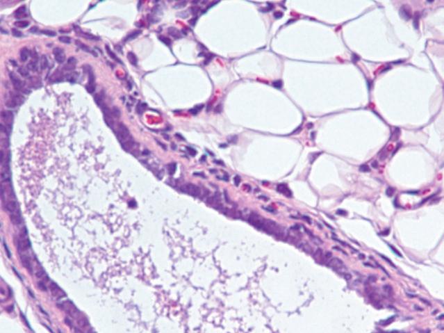 Alimonti_Supplementry Figure 5 hy/ Mmmry tissue H&E 1 1X 1X