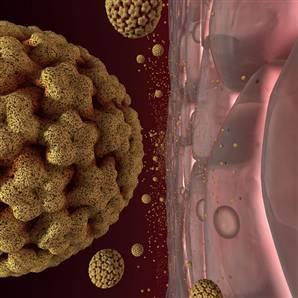 3 NEW TECHNOLOGIES FOR CERVICAL CANCER SCREENING HPV DNA TESTING A sample of cells is collected from the cervix or