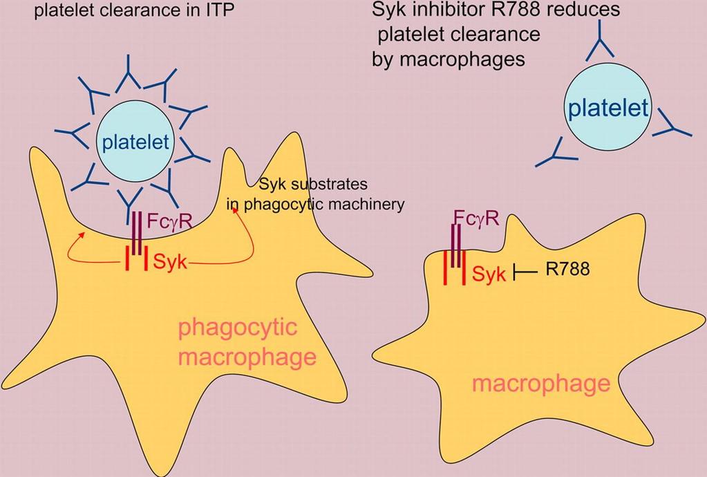 Fostamatinib inhibits Immune-mediated clearance of antibodyopsonized platelets in patients