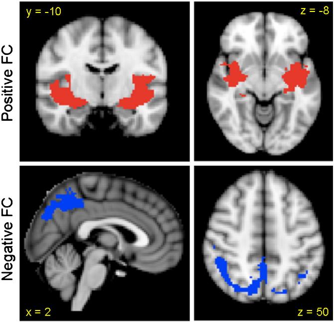 624 A.K. Roy et al. / NeuroImage 45 (2009) 614 626 Fig. 6. Regions of convergence among amygdala subdivisions.