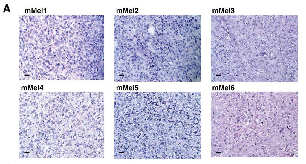 Tumor cell morphologic feature (Pathology evaluation) Figure 1A.