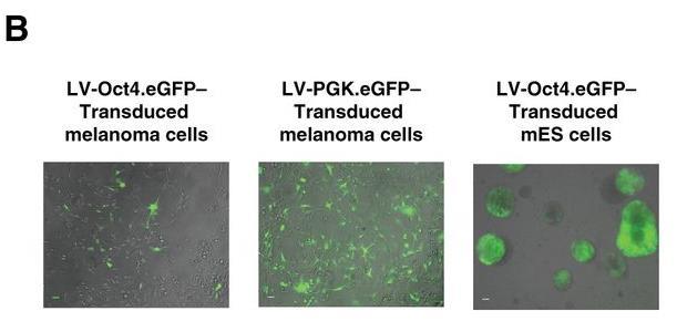 egfp expression in melanoma cells To confirmed that both primary melanoma cells and murine embryonic (mes) stem cells could be transduced efficiently Samples 11.5%±2.