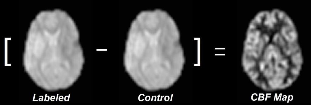 the control image and one with labeling, the labeled image. Fig.