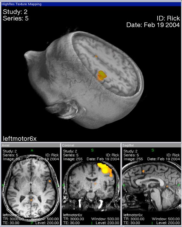 Blood very likely may rush to each region of the cortex according as it is most active, but of this we know nothing.