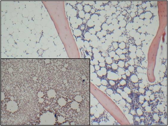 Representative images from bone marrow aspirate