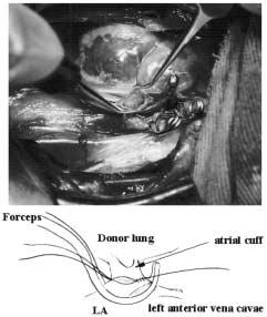 Surgical Technique of Lung Transplantation in Rabbits 4) Postoperative care All rabbits received Cefazoline (5 mg/kg) intramuscularly for 5 days postoperatively.