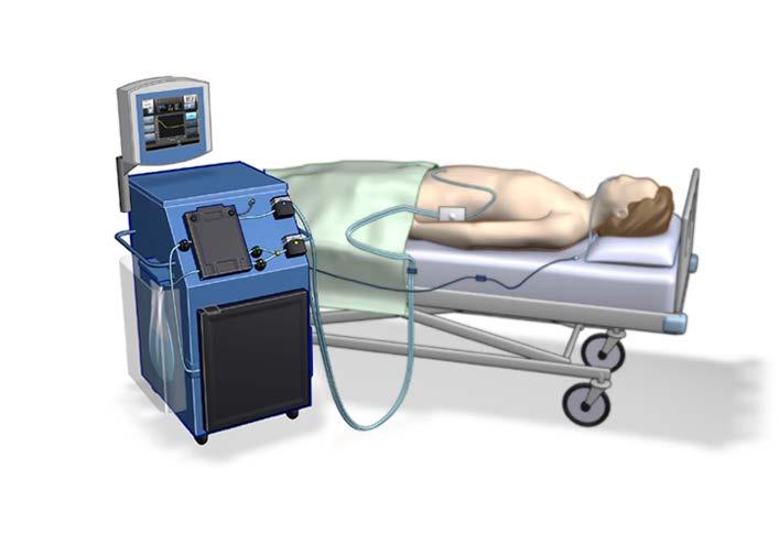 Peritoneal Catheter Touchscreen Interface Solid state Cooling, Warming