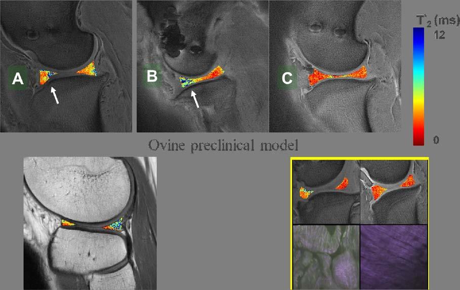 (A-D) UTE MRI and (E-F) histology of prepared cartilage/bone samples: (A) UCC-only; (B) UC/CC/bone; (C) CC/bone; (D) bone-only. UCC=uncalcified cartilage, CC=calcified cartilage.