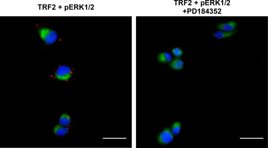 Slides were analysed on an Axio Scan Z1 slide scanner. Supplementary Figure S4: Interaction of TRF2/pERK does not occur in mitochondria.