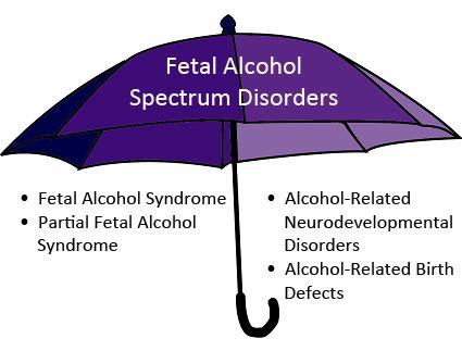 Neurodevelopmental Disorder associated with Prenatal Alcohol Exposure 4 Behavior often appears to be purposeful Typical approaches to difficult behaviors often don t work Many individuals with an