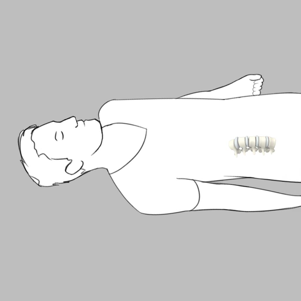 access to the lumbar spine from a standard anterior approach.