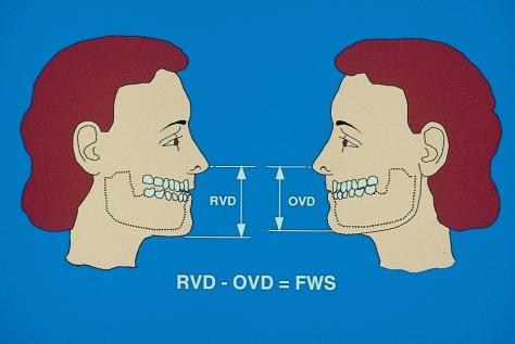 6 Registration: Stage II intermaxillary relations J. F. McCord, 1 and A.