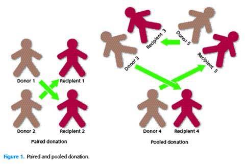Living donor types Related Non related : directed Altruistic