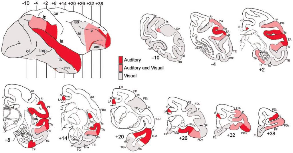 Cortical areas related to the processing of auditory,