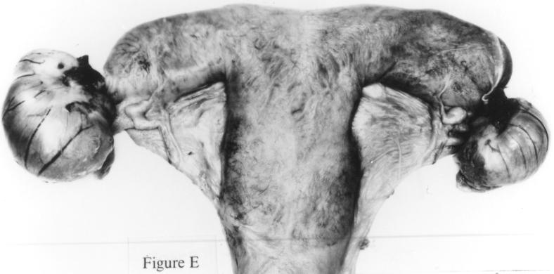 The walls of the body and horns of the uterus are thickened and have reasonable tone; E: uterus and ovaries of a mare (Mare E) in oestrus 1 2 days before ovulation during
