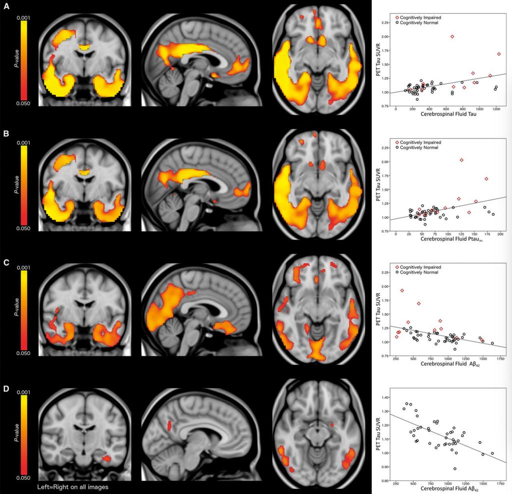 Recent AV45-CSF tau studies Harvard Aging Brain Study N=3 Normals Wash U