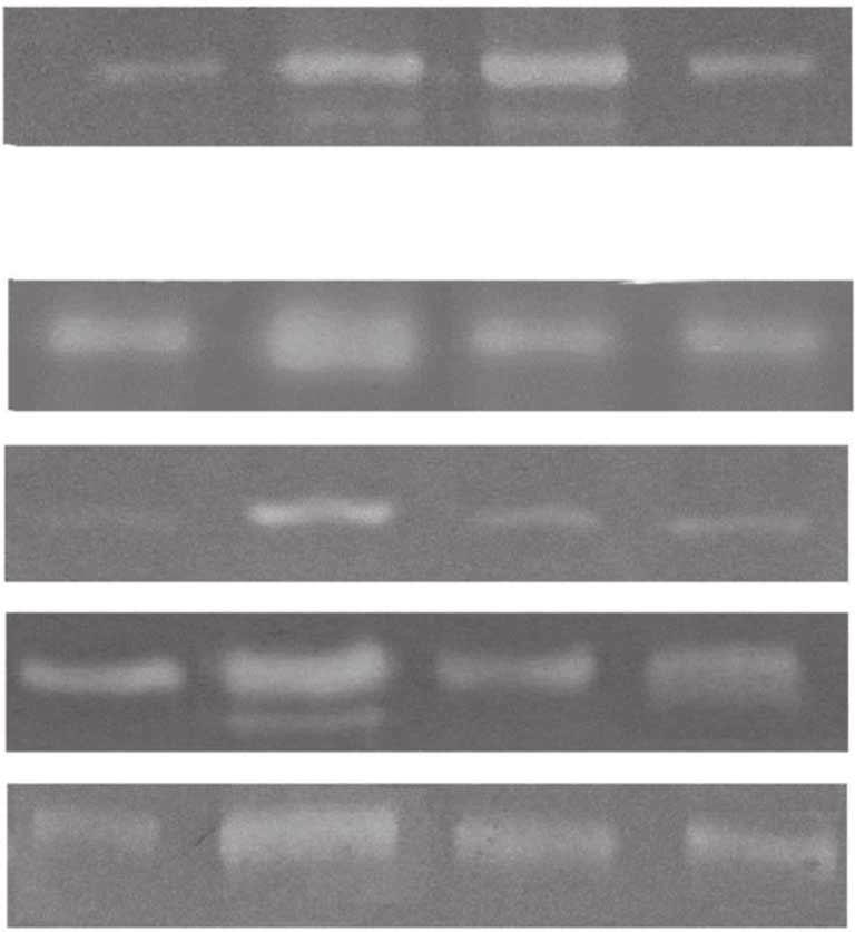 BALF from mouse 88 kda PBS +isotype +antiantibody HMGB1 antibody Neutrophil 16-HBE PBEC 88 kda A549 HMGB1 (ng/ml) IL-1b (ng/ml) 1000 1000 2 2 Supplemental Figure 5 Gelatinase production in BALF of
