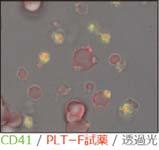fragment by the differences in staining Platelet RBC Fragment Transmitted light