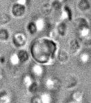 reticulum (ribosomal RNA) Mitochondria (MtDNA) open tubule