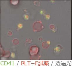 PLT-F separates platelets from RBC fragment by the
