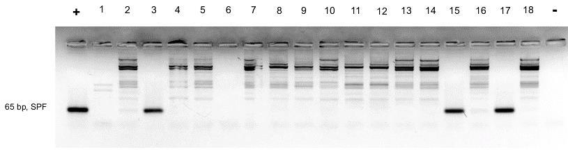 5 years. A B Figure 19. HPV DNA detection in fresh HNSCC samples. Representative PCRs using A) PGMY and β-globin and B) SPF10 primers.