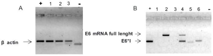 4.2.1 E6 mrna in FFPE HNSCC samples All HNSCC samples that have been positive for HPV DNA (n = 45), except of the two recurrent tumors, have been included in the E6 mrna analysis, which makes 43