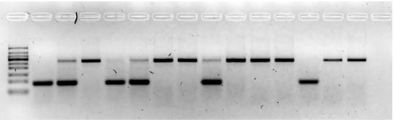 2 E6 mrna in freshly collected HNSCC samples From a total of 14 HPV DNA positive samples, 2 samples were HPV-18 positive, and thus were not included in the HPV-16 E6*I analysis, leaving 12 samples in