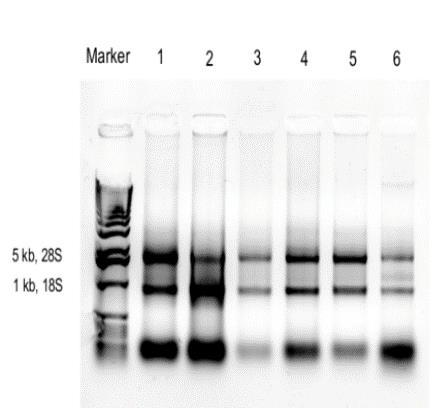 Figure 30. Agarose gel electrophoresis of the RNA isolated from fresh tumor samples. RNA from 9 HNSCC fresh tumors was visualized on a 1% agarose gel.