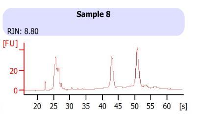 After mirna libraries quality and quantity control, NGS experiment was performed on NextGen 500 machine. The run data was accessed through Basespace platform (Illumina, USA).