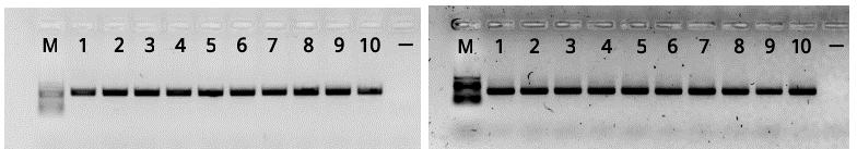 LAIR2 and 4 CpG for FBXO2. After confirming successful PCR amplification (Figure 42), PCR amplicons were ready for the pyrosequencing. Results are presented in Figures 43 and 44. A B C D Figure 42.