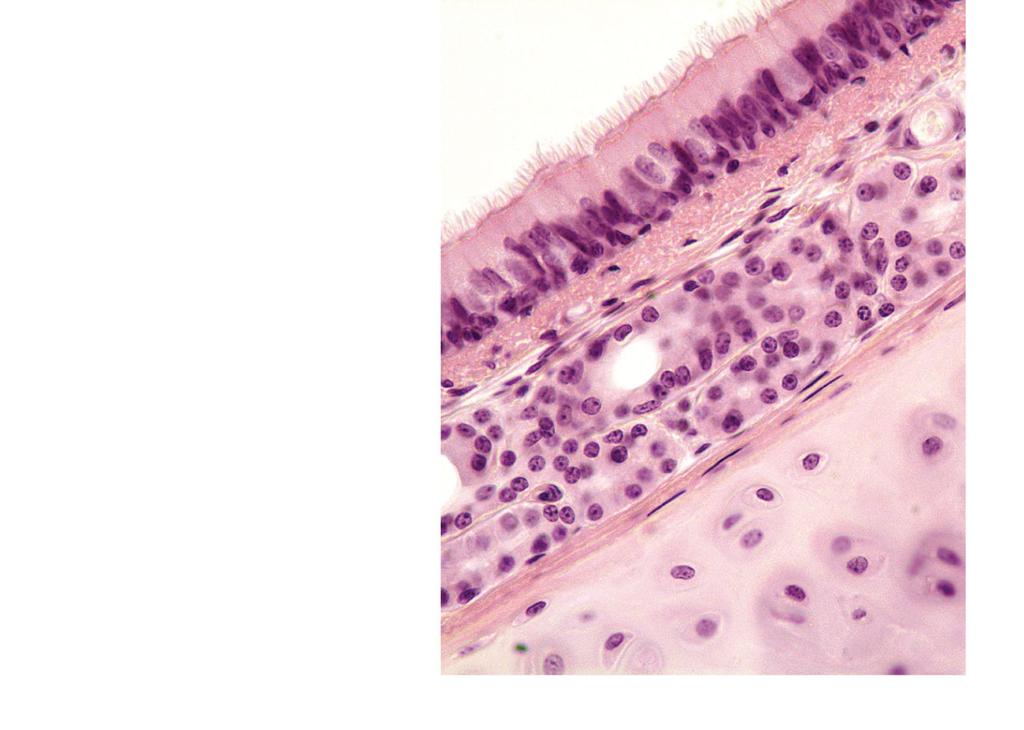 Mucosa Pseudostratified ciliated columnar epithelium Lamina propria (connective tissue) Submucosa