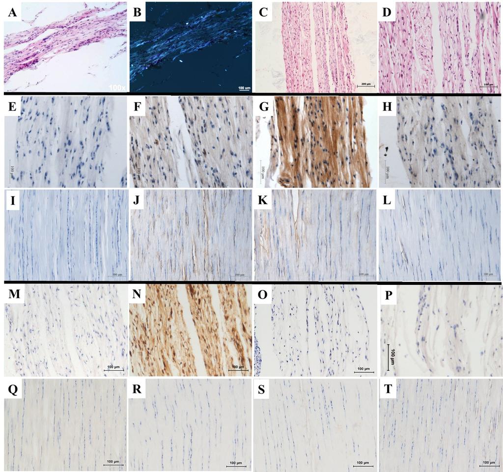 ESFTT: Engineered Scaffold-Free Tendon Tissues ESFTT ESFTT Patellar ESFTT Tendon Patellar Tendon HE staining Polarization HE, x 100 HE, x 200 Negative Control Tenomodulin Type I collagen Type
