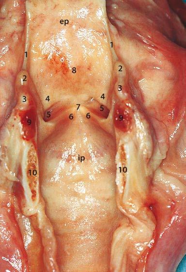 INTERNAL ANATOMY Vestibule -Aditus à vestibular folds Vestibular folds -Mucous membrane + connective tissue (vestibular ligament) - Thyroid cartilage à arytenoid cartilage